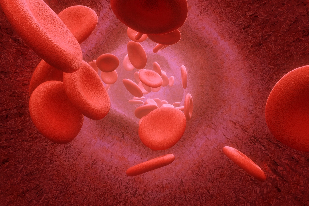 Blood Clots and Autoimmune Diseases: What's the Link?